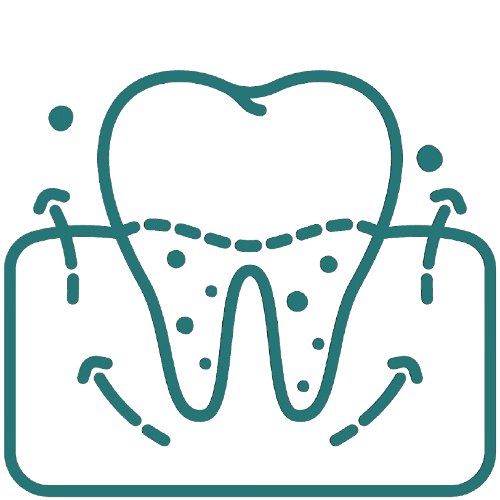 Dental scaling